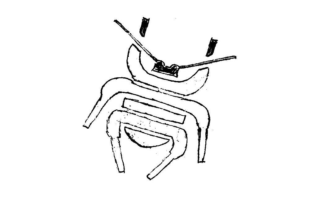 甲壳虫图形